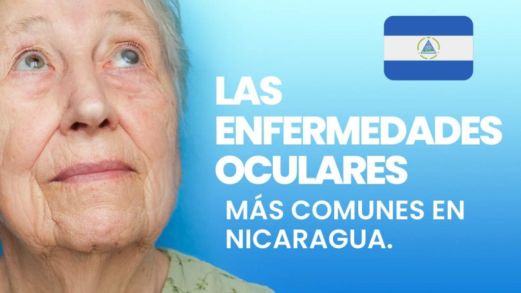 Las enfermedades oculares más comunes en Nicaragua.